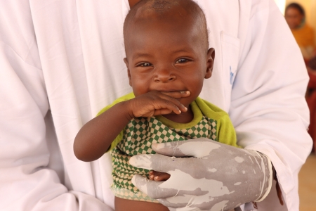 Doctor holds baby eating fortified food in Mali